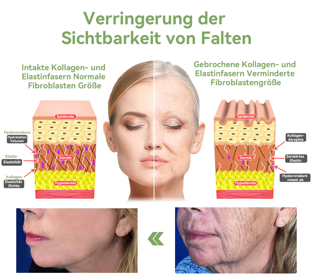 Vorschaubild 10